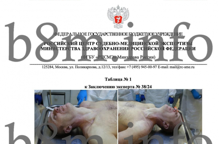 Тг-канал &laquo;Черное зеркало&raquo; опубликовал результаты официальной экспертизы Навального. Они опровергают официальную же причину смерти